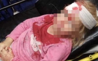 Ребенок пострадал в аварии с военным джипом в Гродно