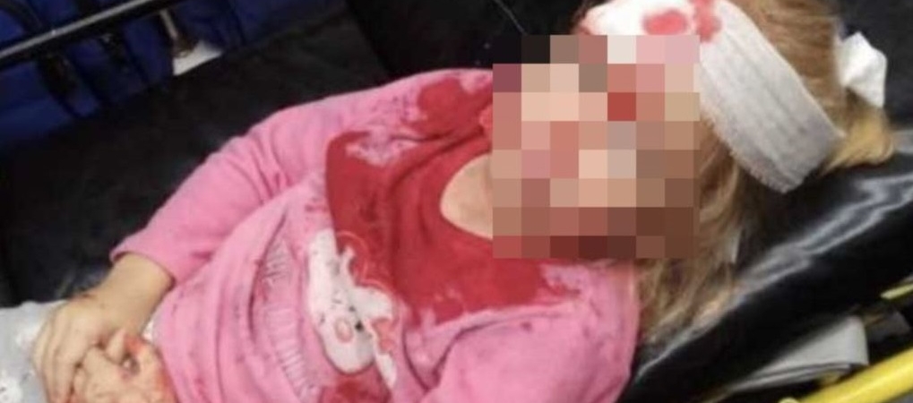 Ребенок пострадал в аварии с военным джипом в Гродно