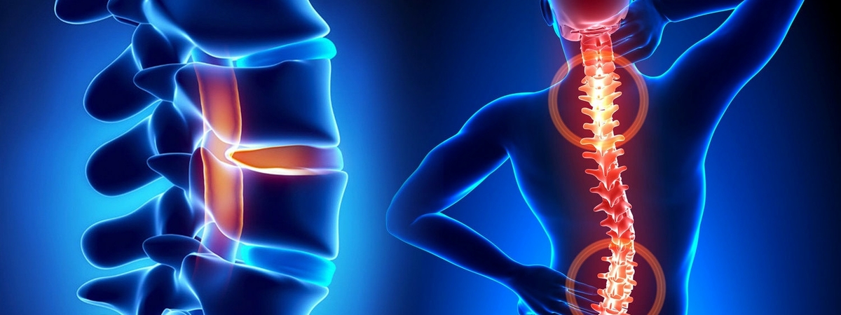 Стоять, спина: Как гусарским методом перебороть боль от остеохондроза