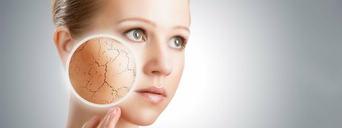 Шелушения и покраснения - ариведерчи: Косметолог рассказала, как вазелин оздоровит кожу