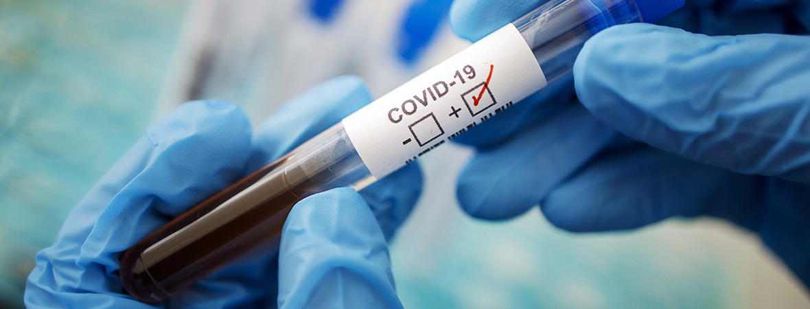 Если вы не знали, что болели коронавирусом: врачи назвали важные симптомы