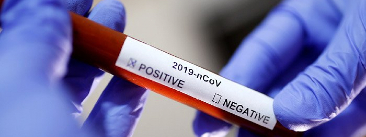 ВОЗ передала в Беларусь 6 тысяч тестов на коронавирус