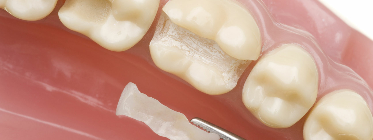 Почему болит запломбированный зуб