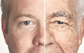 Медики рассказали, с какого возраста люди безвозвратно стареют