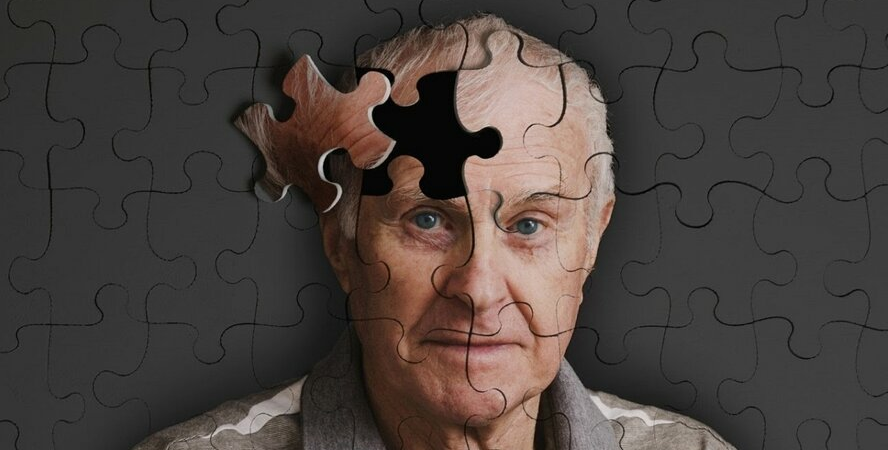 Как остановить старение мозга  ответ ученых 