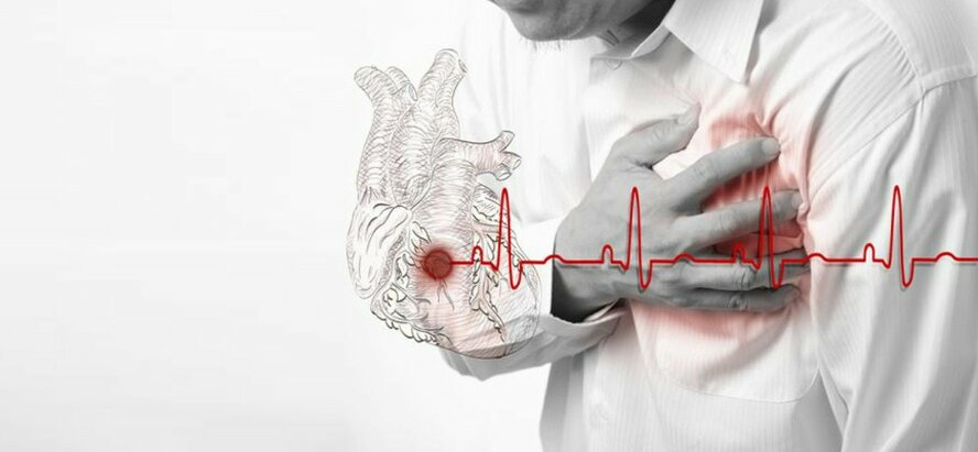 Как тело предупреждает нас об угрозе смерти 5 явных признаков скорого инфаркта