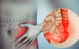 Синдром раздраженного кишечника: как распознать и лечить