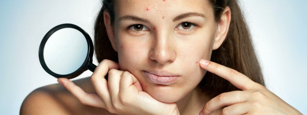 Ученые рассказали о 7 признаках проблем со здоровьем, видимых на лице