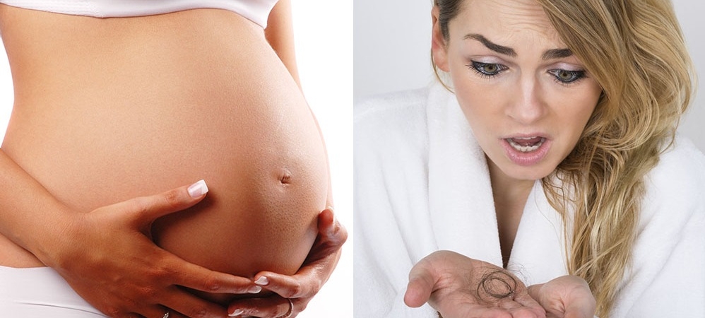 Как беременность и роды влияют на волосы: рассказ одной мамы