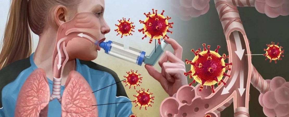 Хроническая астма и аллергия: лечим народными средствами