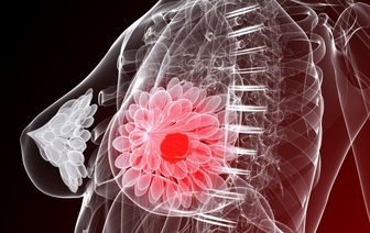 То, что увеличивает риск каждой женщины получить рак молочной железы