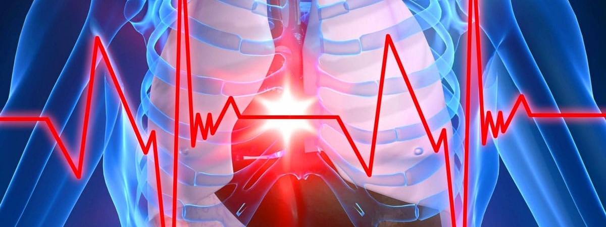 Кардиологи назвали 6 неожиданных признаков приближающегося сердечного приступа