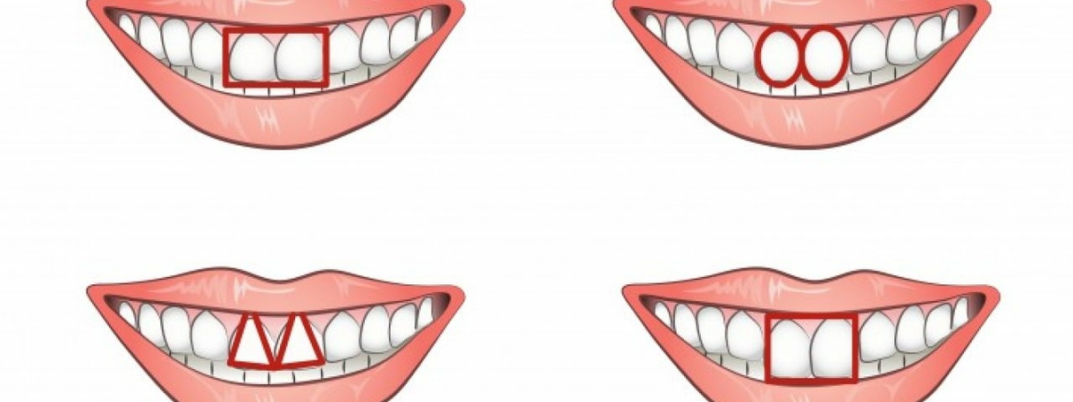 Как по форме зубов можно охарактеризовать человека