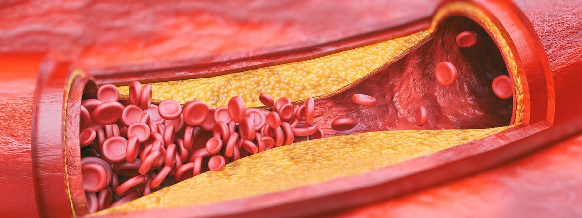 Какая пища может повлиять на уровень холестерина в крови, рассказали медики