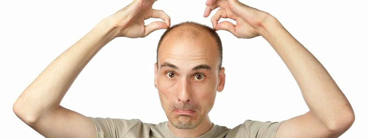 Из Нагиева в Николаева: Найдены 5 продуктов, которые провоцируют выпадение волос