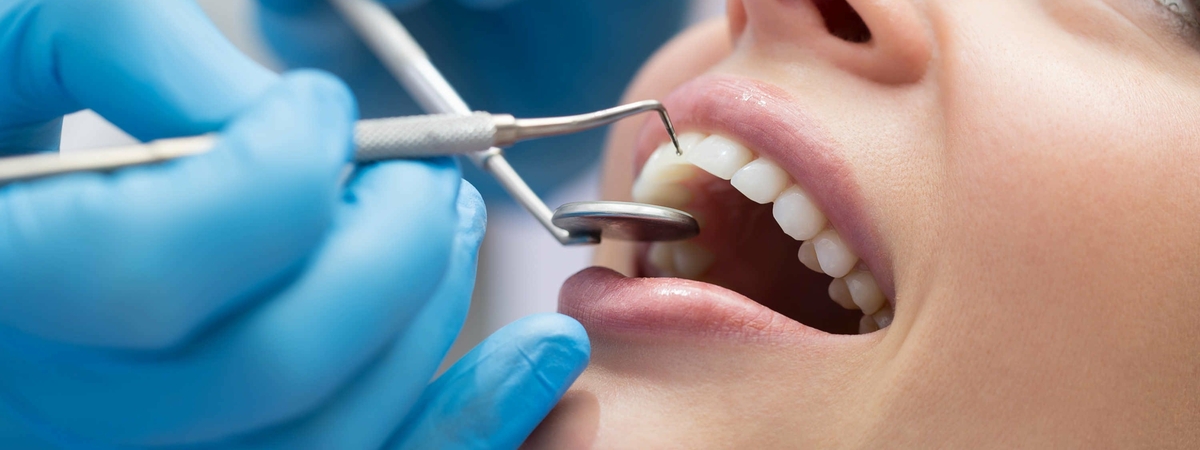 Стоматолог рассказала, что делать, когда шатается зуб