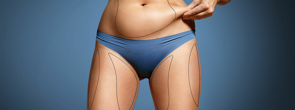Избавиться от «спасательного круга»: Диетолог рассказала, как убрать жир на животе