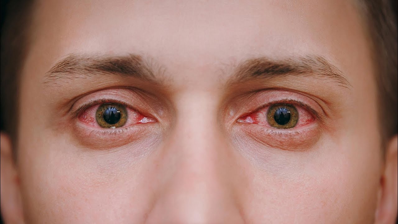 наркотики от которых глаза красные